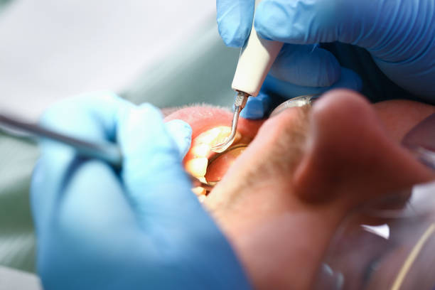Best Pediatric Emergency Dentist in Summerfield, NC