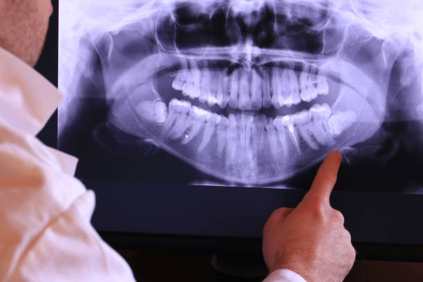 Best Emergency Dental Care for Broken or Chipped Teeth in Summerfield, NC